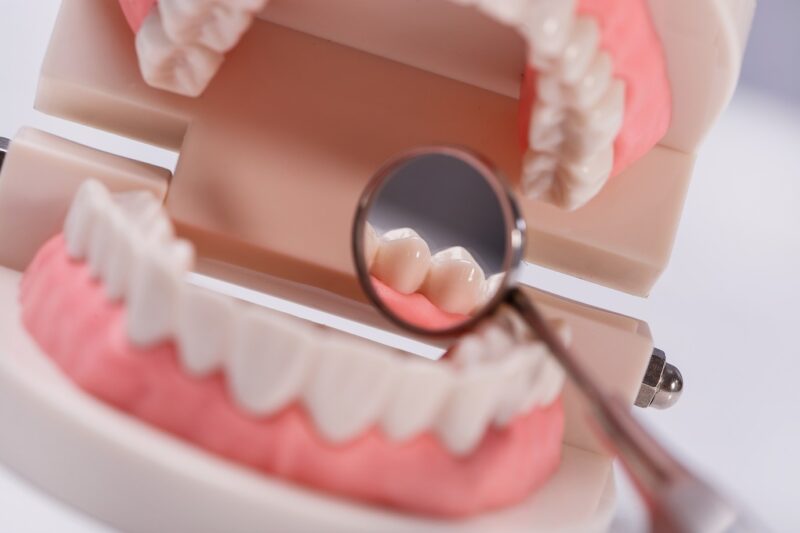modèle de dents blanches